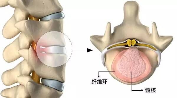 椎間盤結(jié)構(gòu)